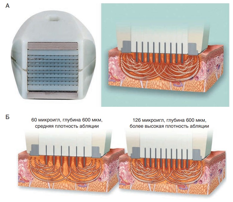 Механизм действия