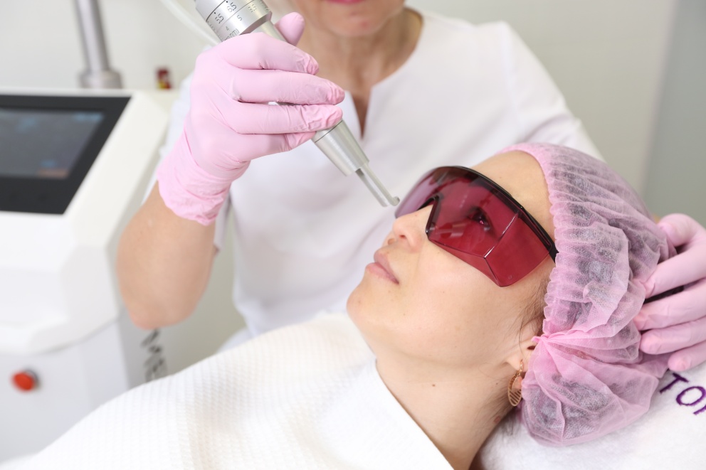 Лазерное удаление сосудов и сосудистых звездочек (лазер MAGIC I®)