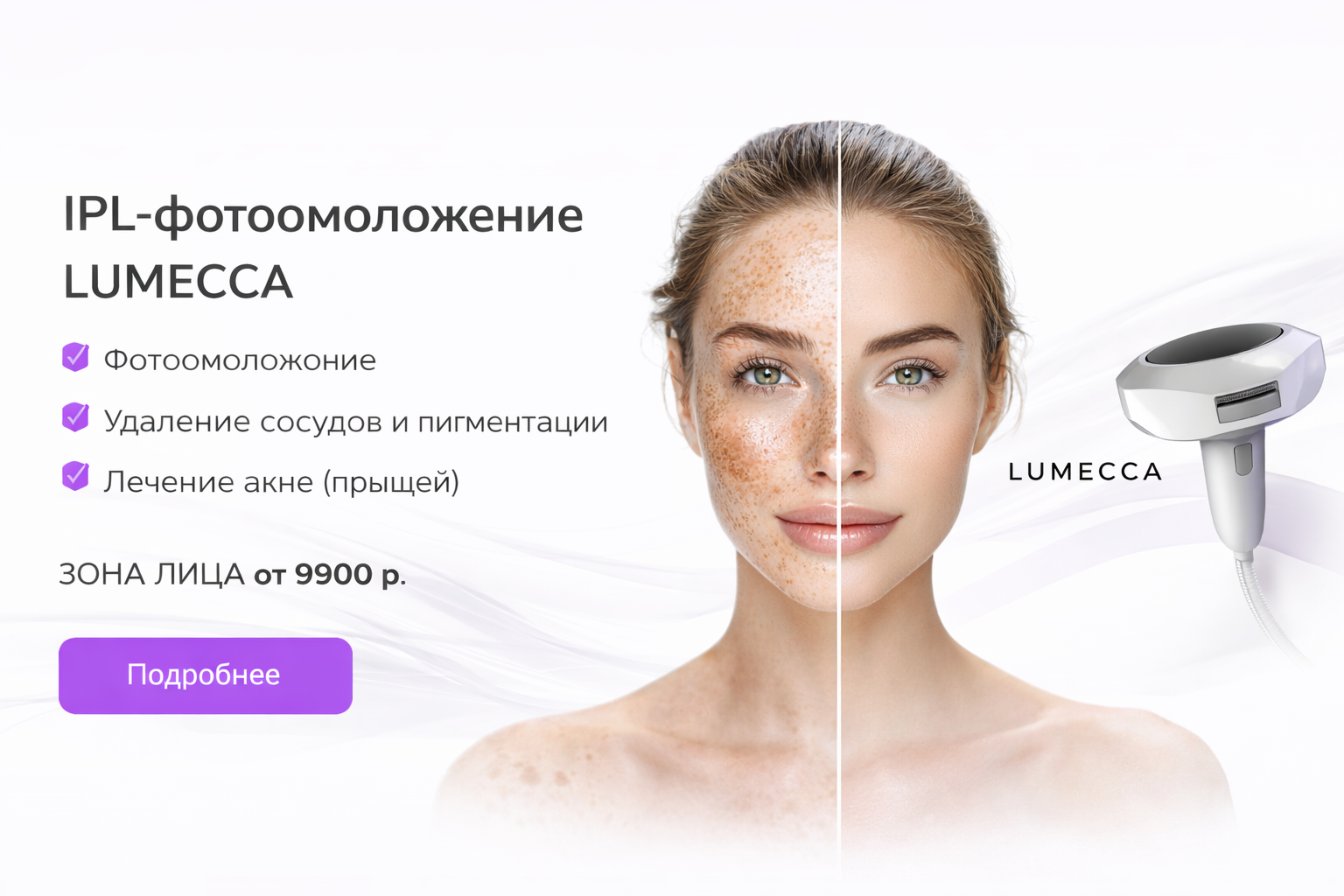 Люмека слайд 1