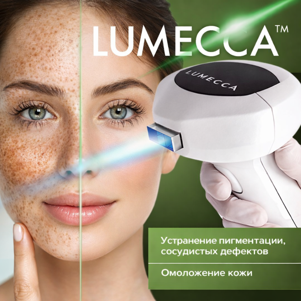 Фотоомоложение (IPL-система LUMECCA®)