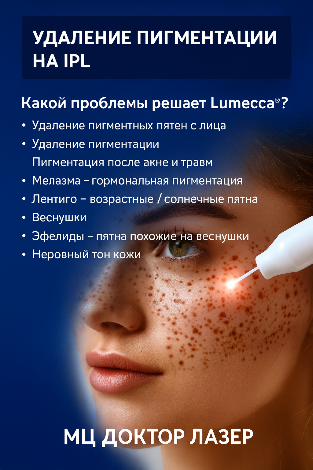 Удаление пигментных пятен от 9900р.