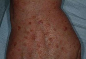 До и после процедуры