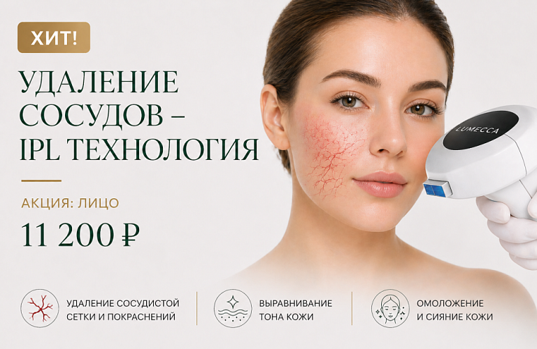 IPL - Удаление сосудов 11200р.